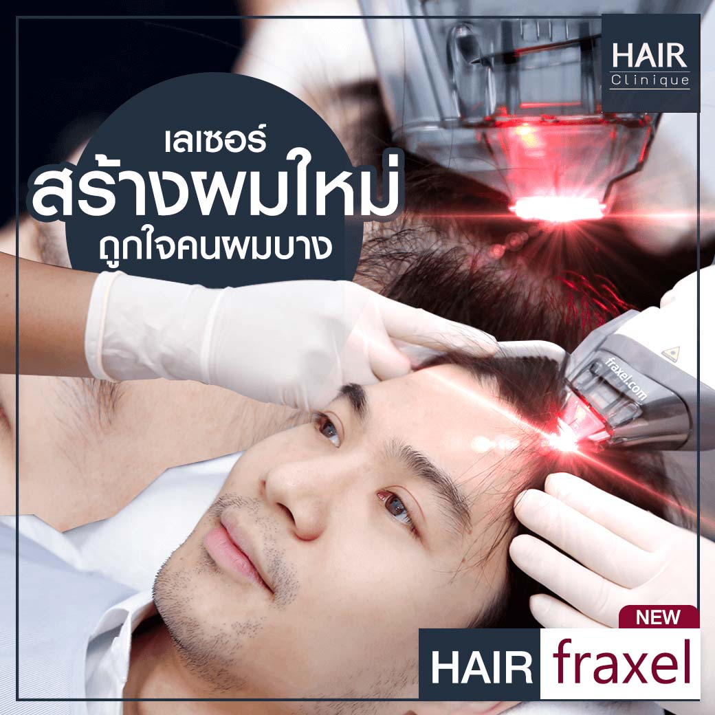 เลเซอร์ปลูกผม-รักษาผมร่วง-Hair Fraxel เลเซอร์รักษาผมร่วง