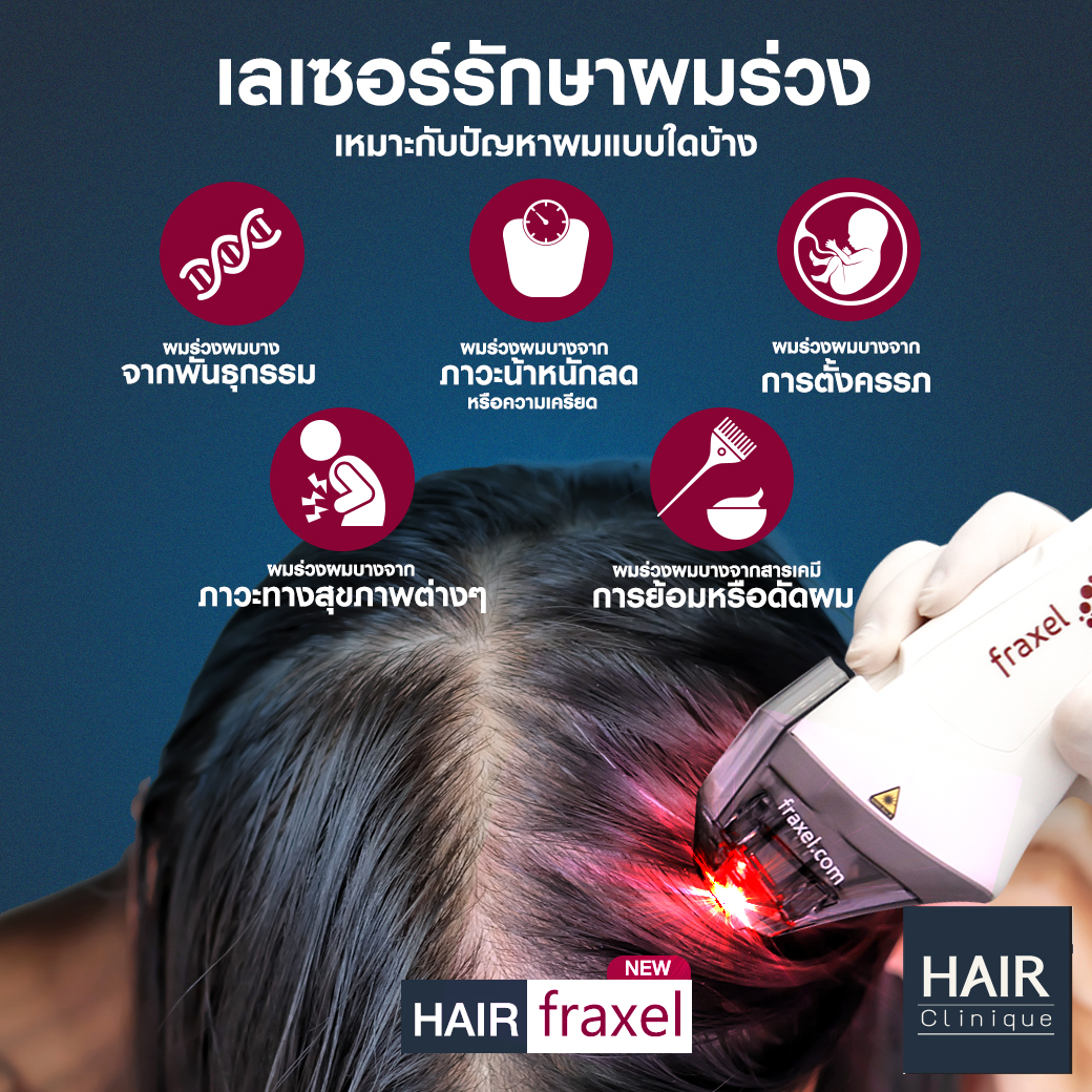 เลเซอร์ปลูกผม-รักษาผมร่วง-Hair Fraxel เลเซอร์รักษาผมร่วง  