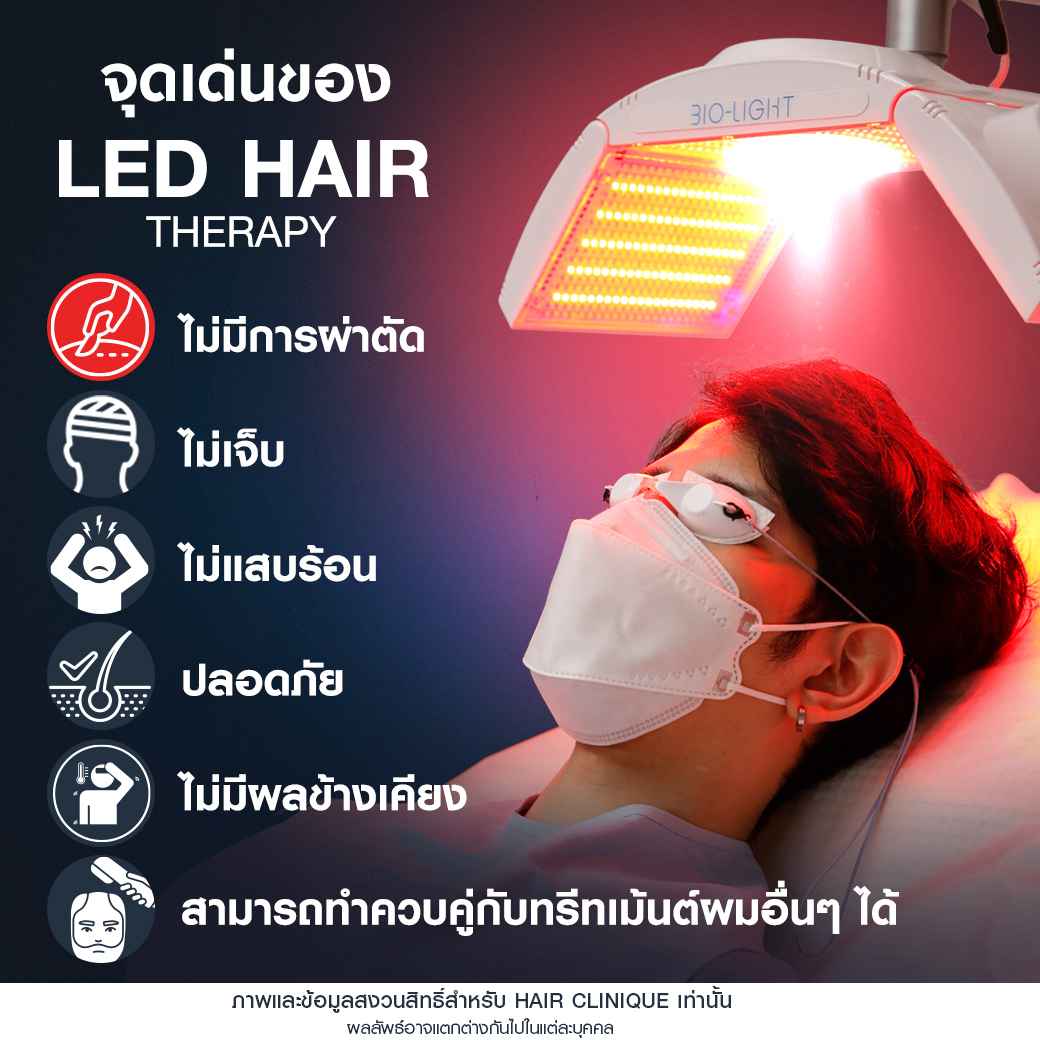 จุดเด่นของฉายแสงled,ผมร่วง,ฉีด Exosome,ฉายแสง led,ฉายแสงลดผมร่วง,แก้ปัญหาผมร่วง,รีวิวฉีดExosome,รีวิวฉายแสง led,