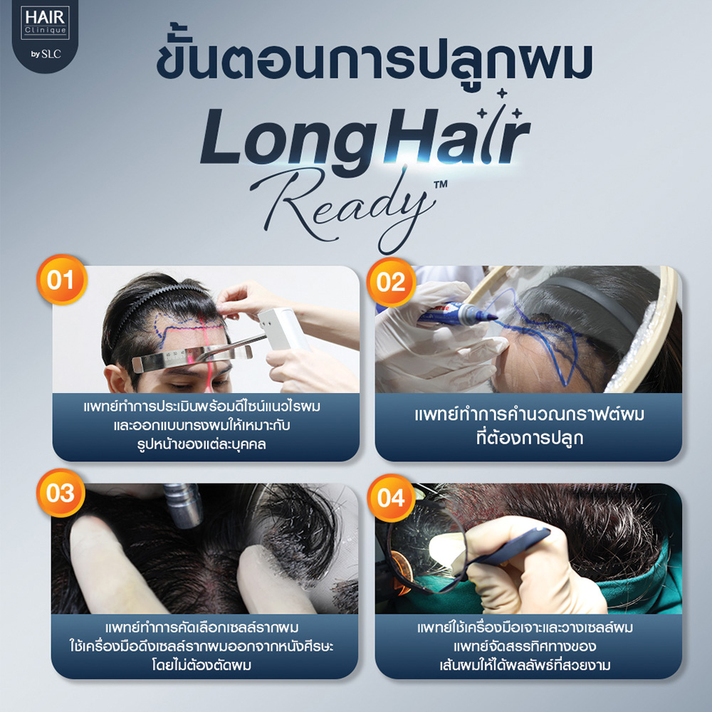 ขั้นตอนการปลูกผมเทคนิค Long Hair Ready™