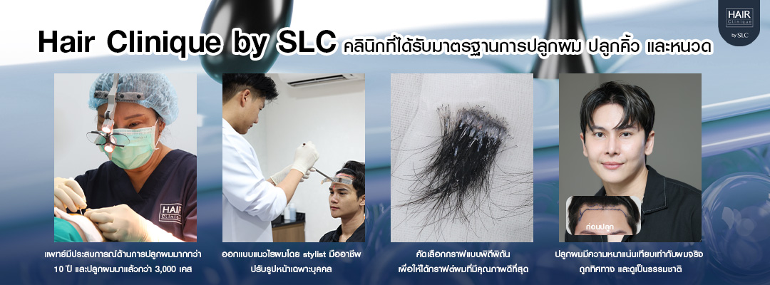 จุดเด่นของการปลูกผมกับ Hair Clinique