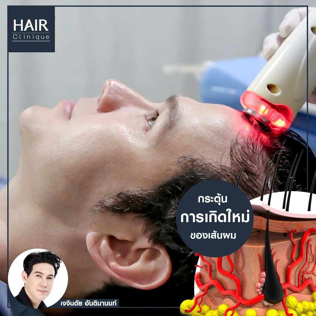 รีวิวPora Cool Hair,ลดผมร่วง,แก้ผมบาง,รักษาผมบาง