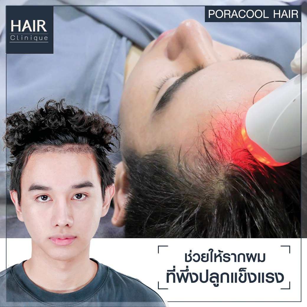 รีวิวPora Cool Hair,ลดผมร่วง,แก้ผมบาง,รักษาผมบาง