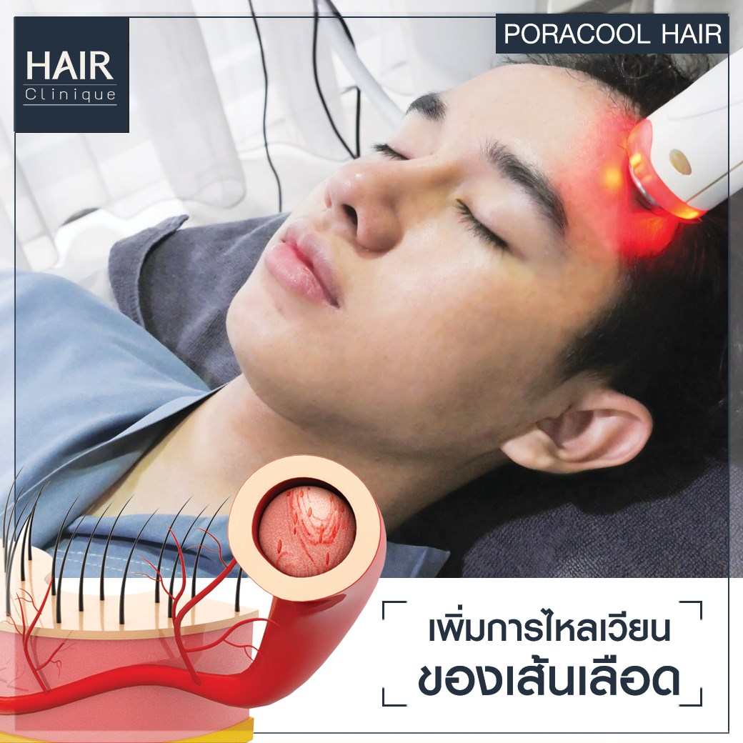 รีวิวPora Cool Hair,ลดผมร่วง,แก้ผมบาง,รักษาผมบาง