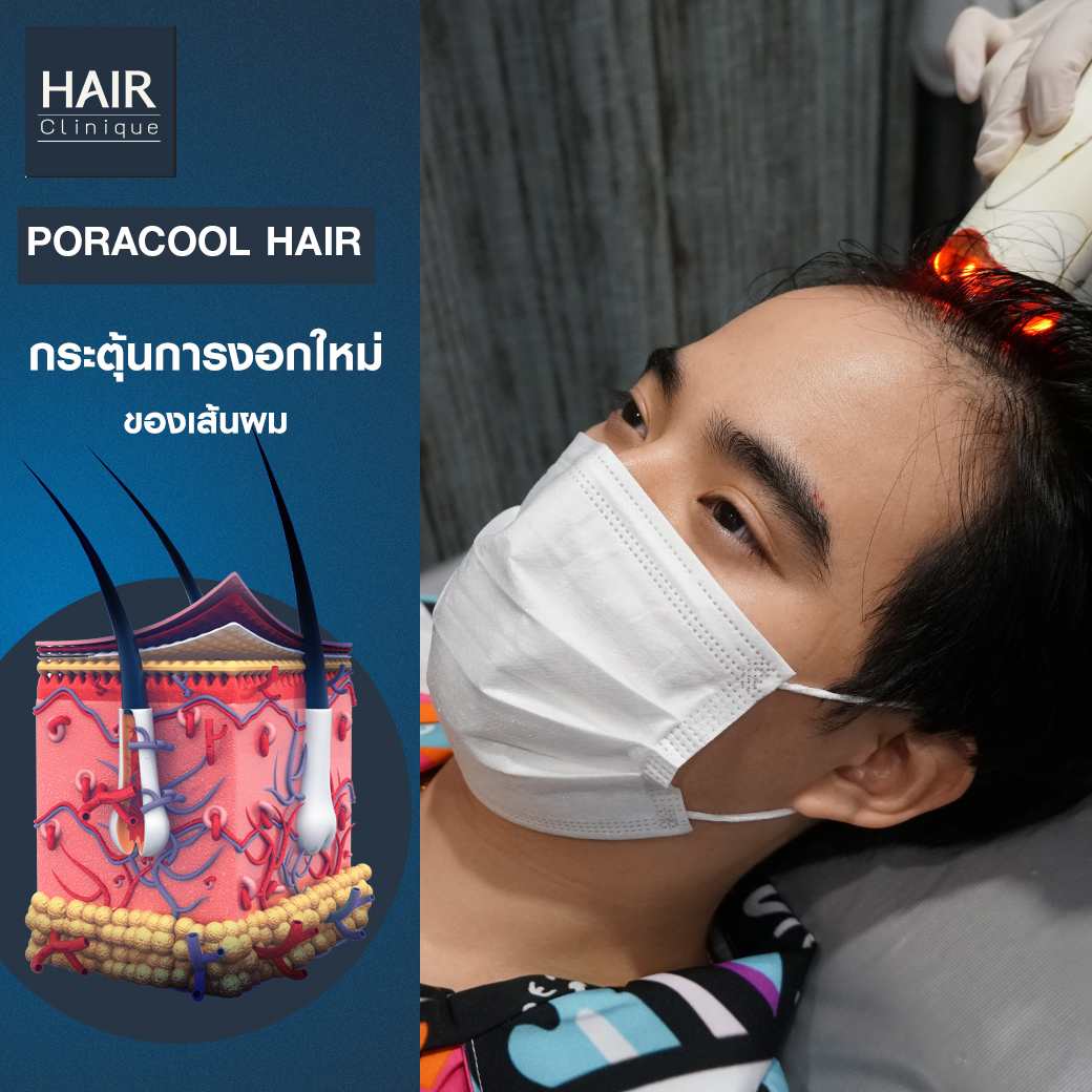 รีวิวPora Cool Hair,ลดผมร่วง,แก้ผมบาง,รักษาผมบาง