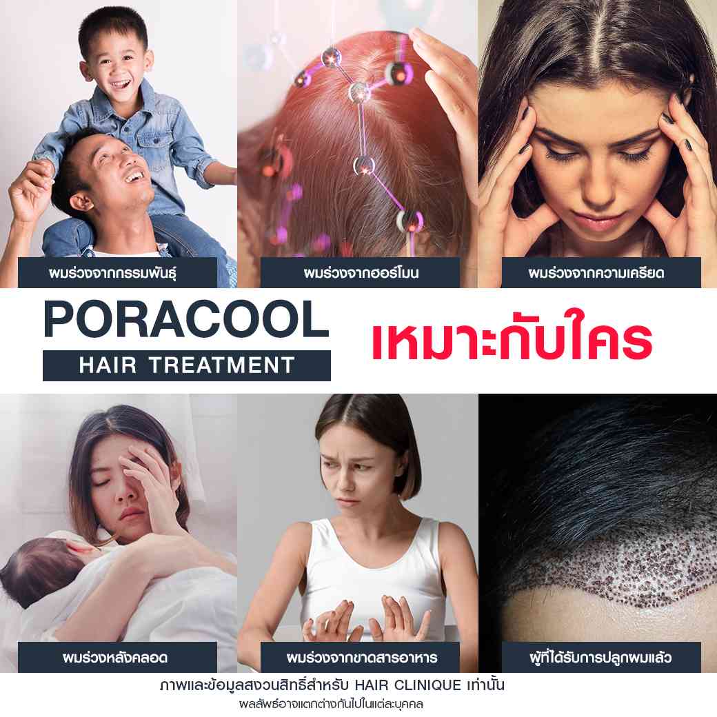 Pora Cool Hairเหมาะกับใคร,ลดผมร่วง,แก้ผมบาง,รักษาผมบาง