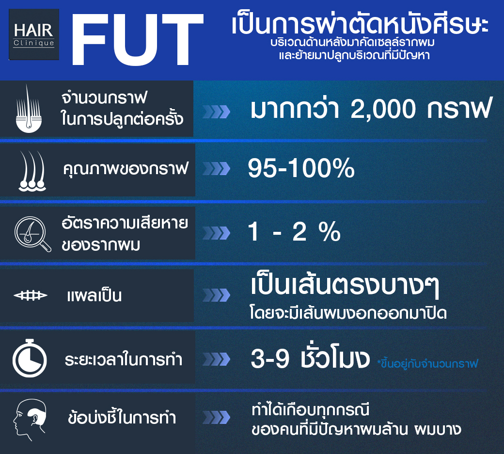 ปลูกผมfut