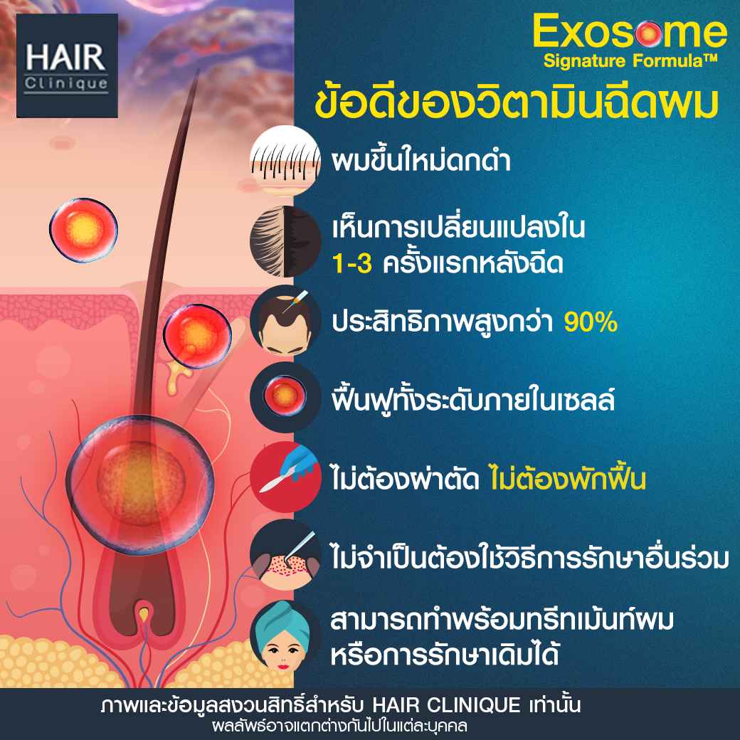ข้อดีการฉีดExosome,วิตามินผมร่วง,วิตามินบํารุงผม ผู้ชาย,วิตามินฉีดผม,ฉีด Exosome ผม ที่ SLC,Exosome HairClinique,ExosomeHair,Exosome Signature Formula™