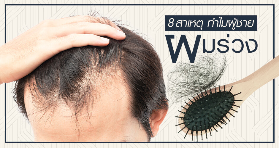 8 สาเหตุ ทำไมผู้ชายผมร่วง?