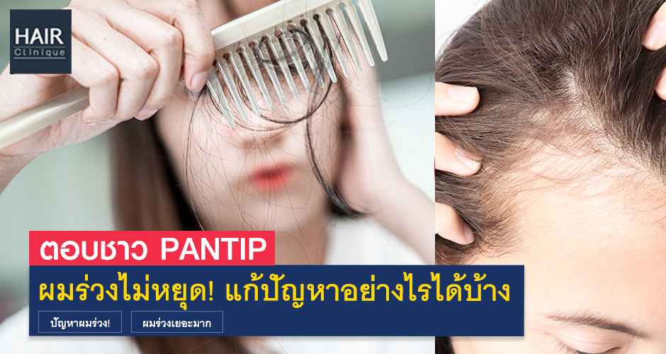 ตอบปัญหาชาว Pantip ผมร่วงไม่หยุด!