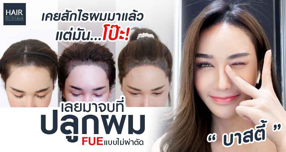 สักไรผมมาแล้ว