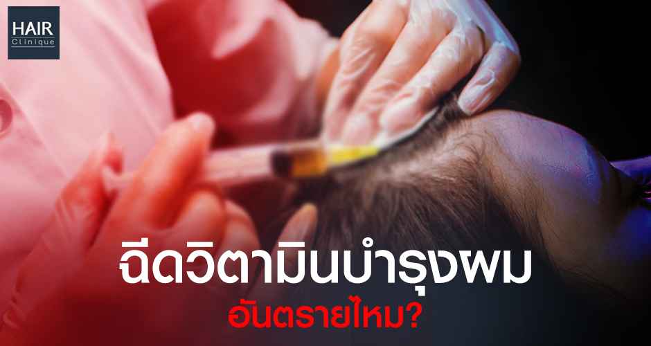 ฉีดวิตามินบำรุงผมนานๆ