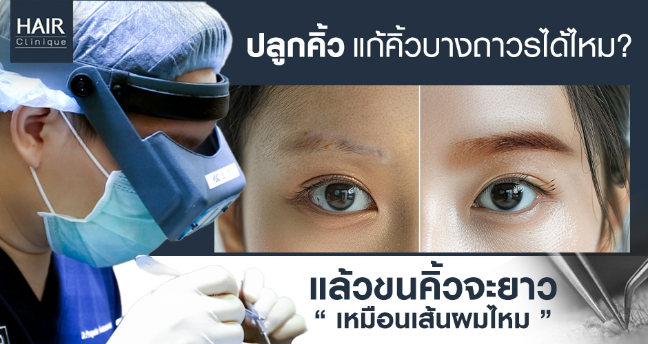 ปลูกคิ้วแก้คิ้วบางถาวรได้ไหม