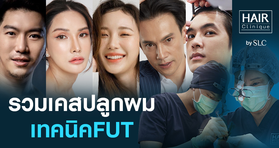 รวมเคสปลูกผม FUT กับแพทย์อเมริกันบอร์ด