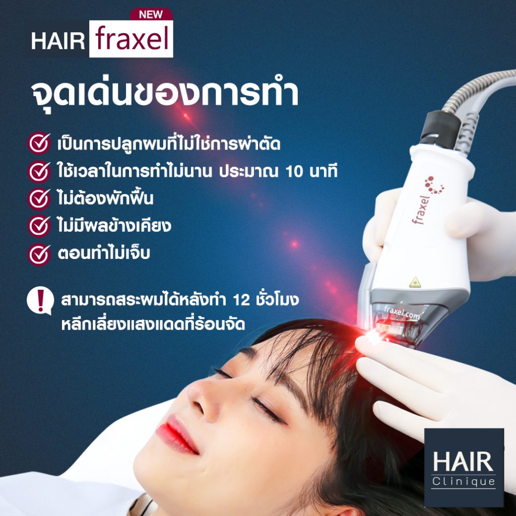 จุดเด่นของการทำเลเซอร์รักษาผมร่วง Hair Fraxel