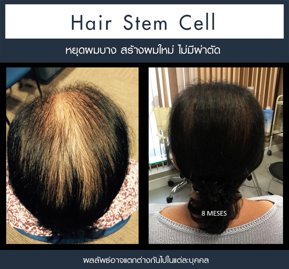 Review Regenera activa 