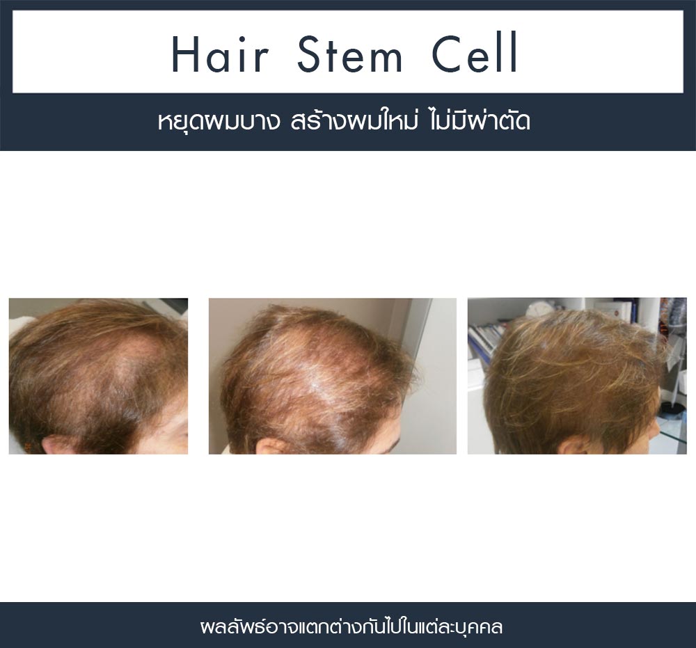 Review Regenera activa 