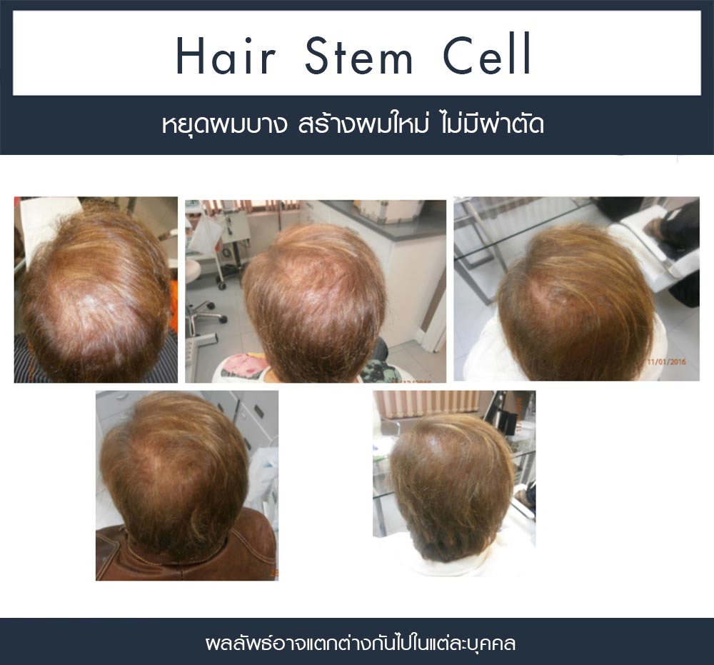 Review Regenera activa 