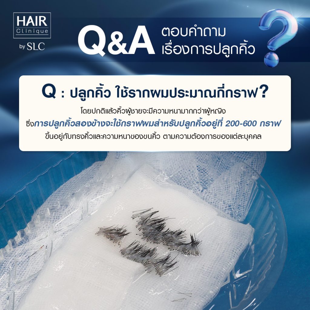 Q&A ปลูกคิ้ว