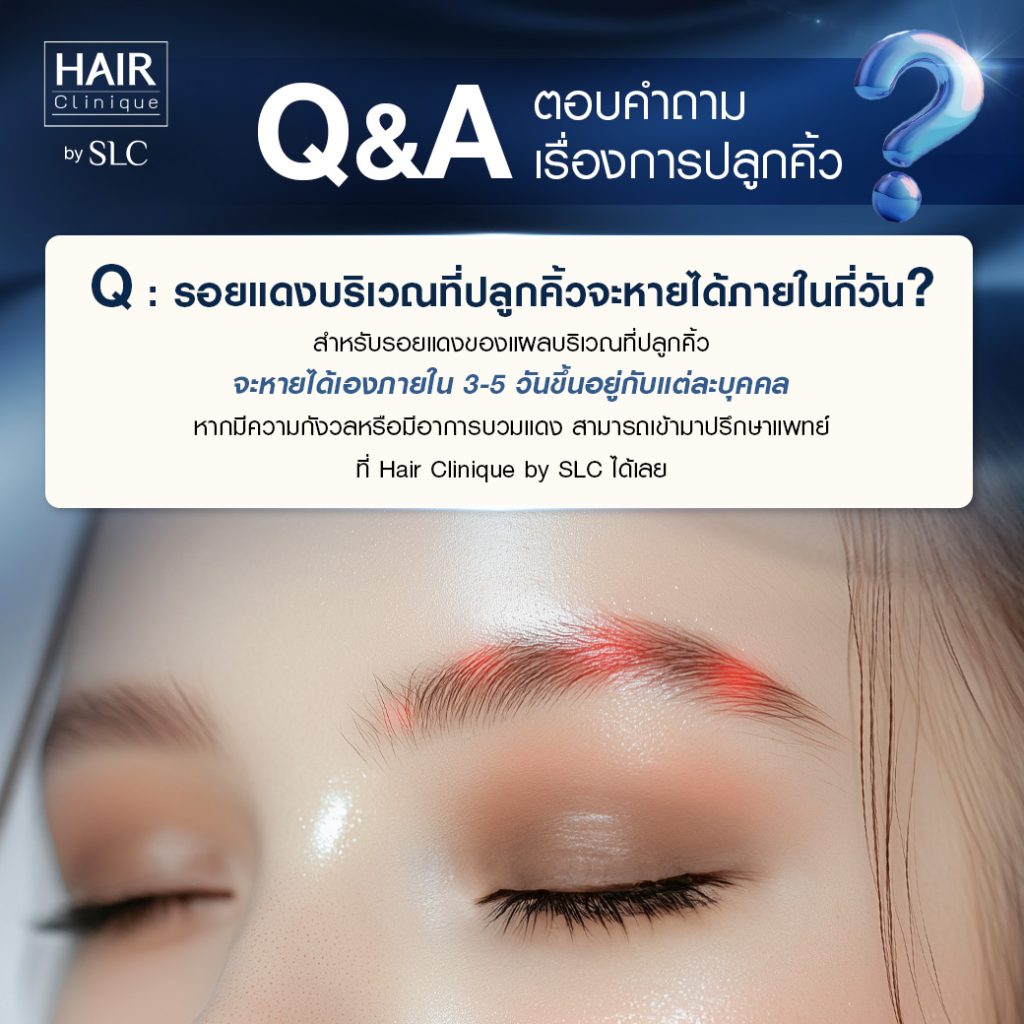 Q&A ปลูกคิ้ว