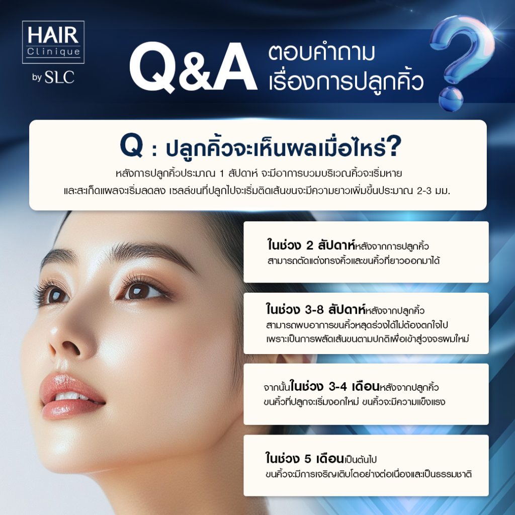 Q&A ปลูกคิ้ว