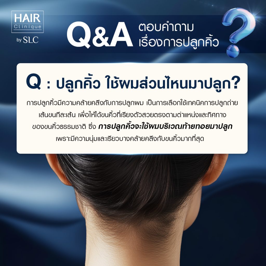 Q&A ปลูกคิ้ว