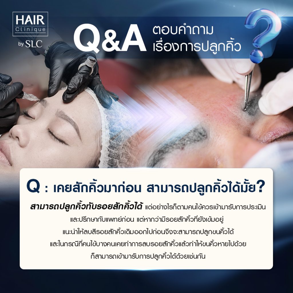 Q&A ปลูกคิ้ว