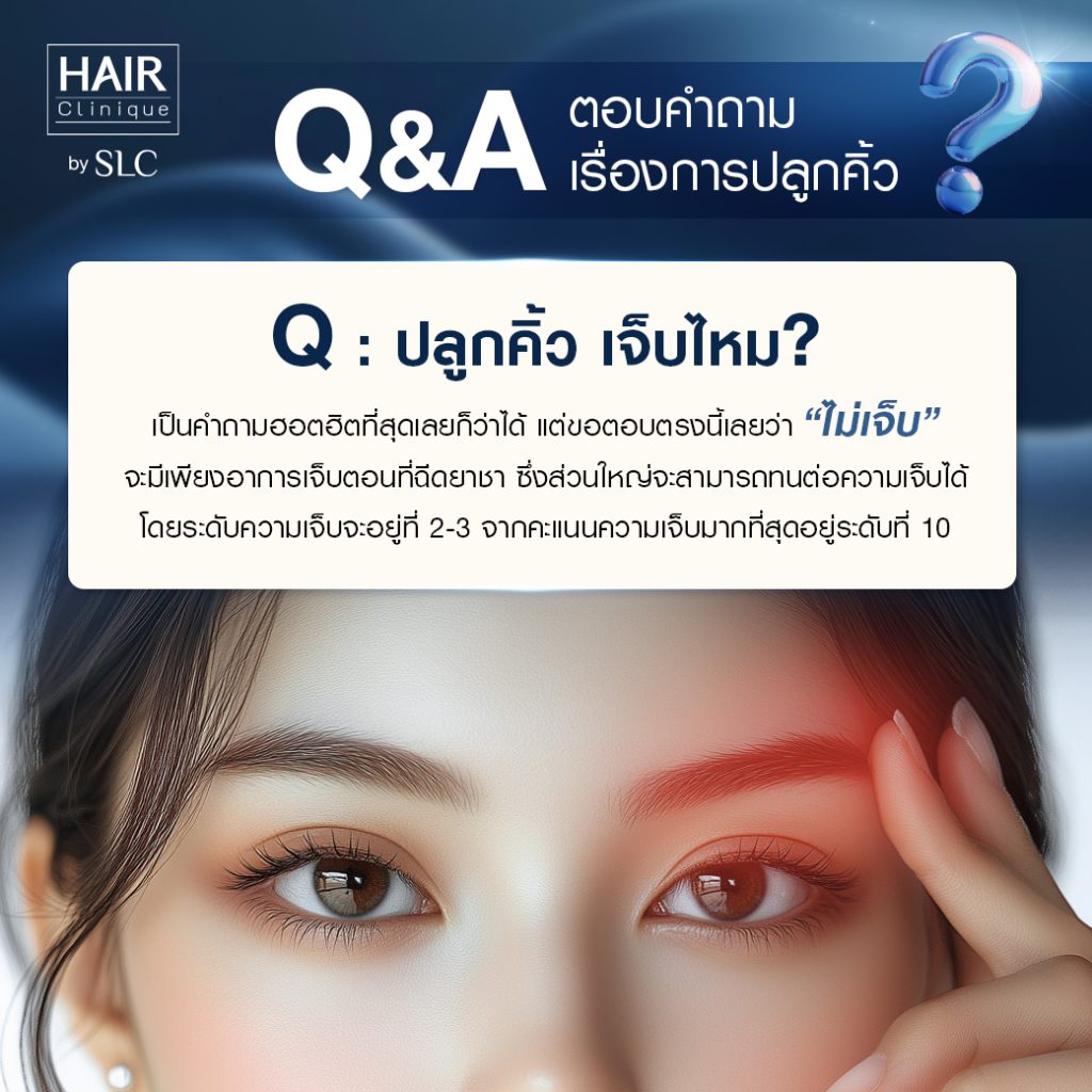 Q&A ปลูกคิ้ว