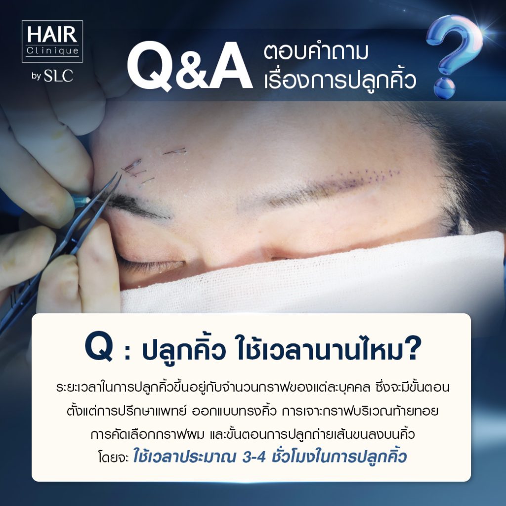 Q&A ปลูกคิ้ว