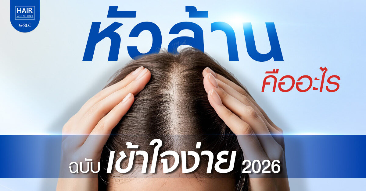 หัวล้าน คืออะไร เกิดจากอะไร รักษาอย่างไร ฉบับเข้าใจง่าย 2026