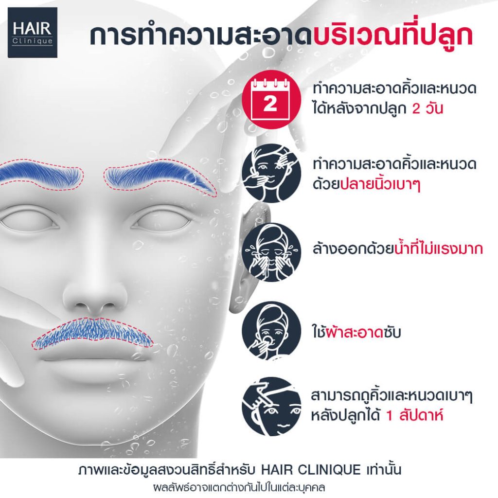 การทำความสะอาดบริเวณที่ปลูกคิ้วปลูกหนวด
