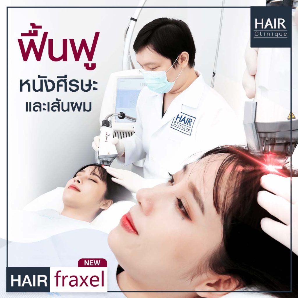 รีวิว Hair Fraxel เลเซอร์รักษาผมร่วง