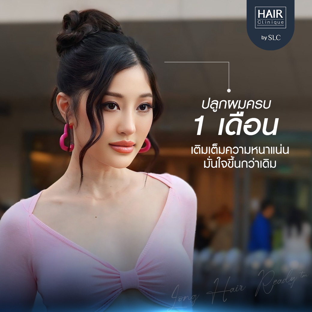 ดาราปลูกผม, ปลูกผมถาวร, ดาราผมบาง, เทคนิคปลูกผม, ปลูกผมที่ SLC, คนดังปลูกผม, มิ้วกี้ ไปรยา