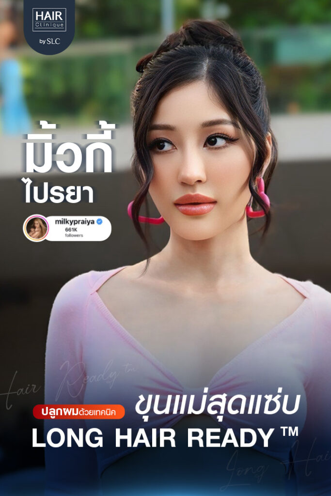 ดาราปลูกผม, ปลูกผมถาวร, ดาราผมบาง, เทคนิคปลูกผม, ปลูกผมที่ SLC, คนดังปลูกผม, มิ้วกี้ ไปรยา