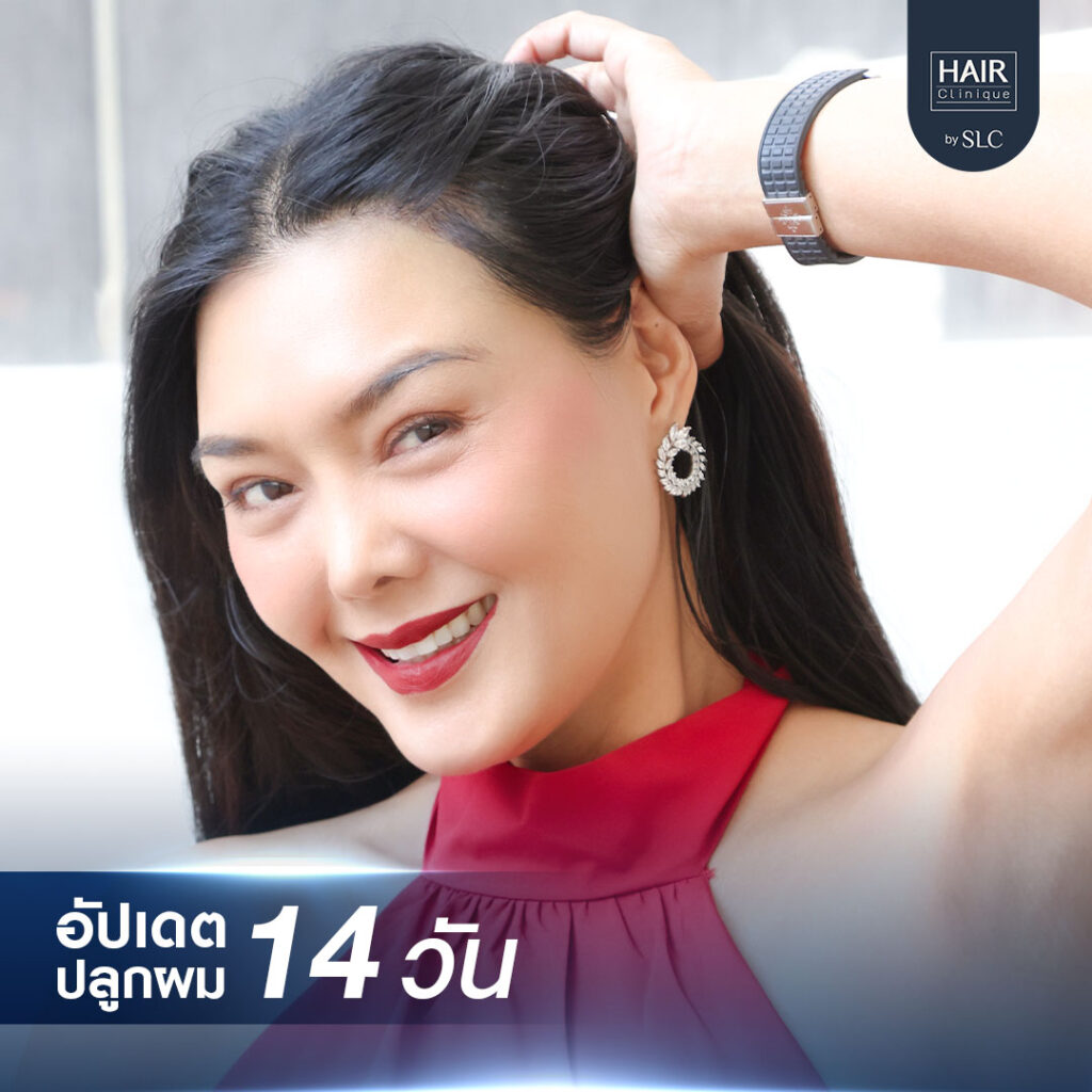 ดาราปลูกผม, ปลูกผมถาวร, ดาราผมบาง, เทคนิคปลูกผม, ปลูกผมที่ SLC, คนดังปลูกผม, ลูกหมี รัศมี
