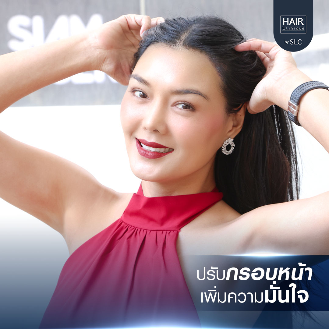ดาราปลูกผม, ปลูกผมถาวร, ดาราผมบาง, เทคนิคปลูกผม, ปลูกผมที่ SLC, คนดังปลูกผม, ลูกหมี รัศมี