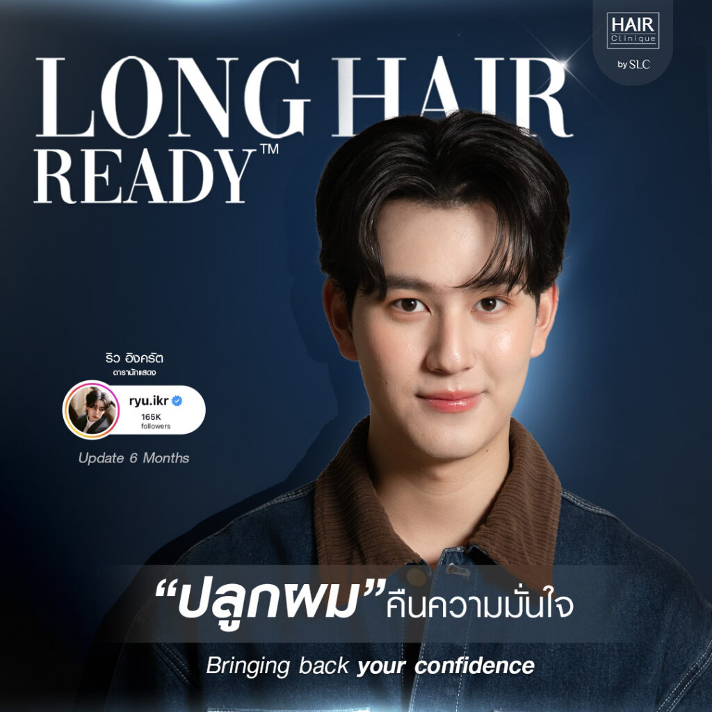 ดาราปลูกผม, ปลูกผมถาวร, ดาราผมบาง, เทคนิคปลูกผม, ปลูกผมที่ SLC, คนดังปลูกผม, ริว อิงครัต