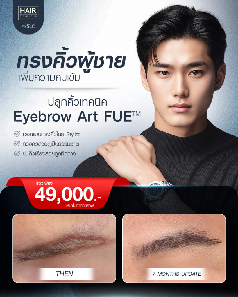 ปลูกคิ้วผู้ชาย, ปลูกคิ้วราคา, ปลูกคิ้วธรรมชาติ, ปลูกคิ้วดีไหม, ปลูกคิ้วที่ไหนดี