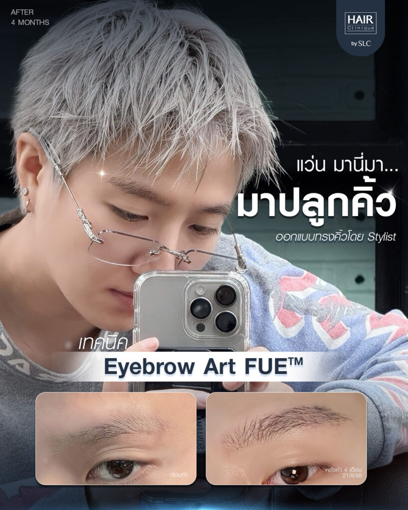 ปลูกคิ้วผู้ชาย, ปลูกคิ้วราคา, ปลูกคิ้วธรรมชาติ, ปลูกคิ้วดีไหม, ปลูกคิ้วที่ไหนดี