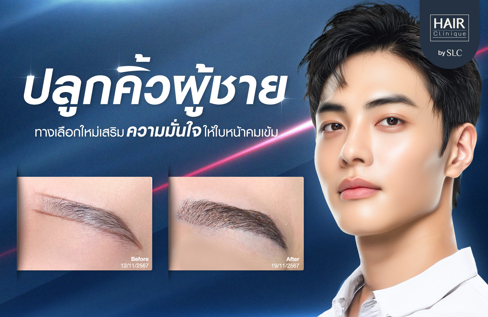 ปลูกคิ้วผู้ชาย, ปลูกคิ้วราคา, ปลูกคิ้วธรรมชาติ, ปลูกคิ้วดีไหม, ปลูกคิ้วที่ไหนดี