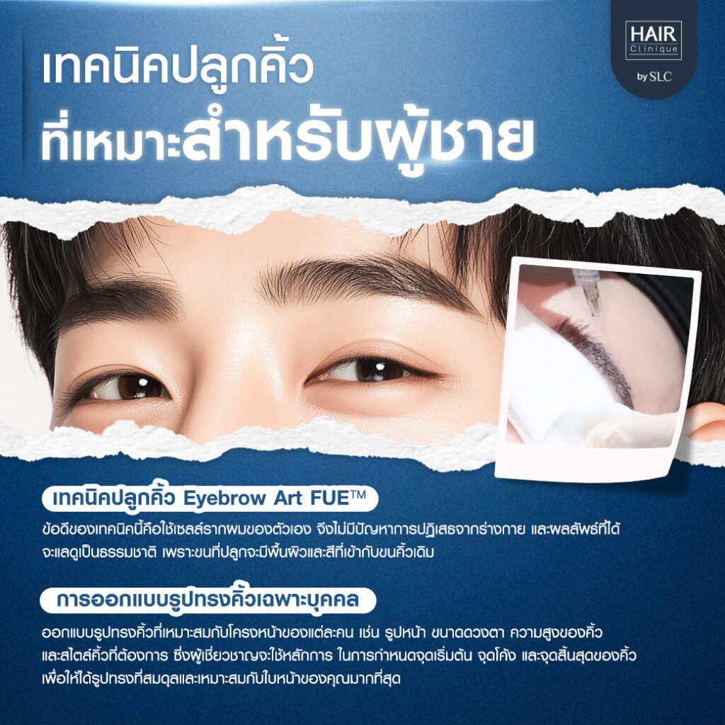 ปลูกคิ้วผู้ชาย, ปลูกคิ้วราคา, ปลูกคิ้วธรรมชาติ, ปลูกคิ้วดีไหม, ปลูกคิ้วที่ไหนดี