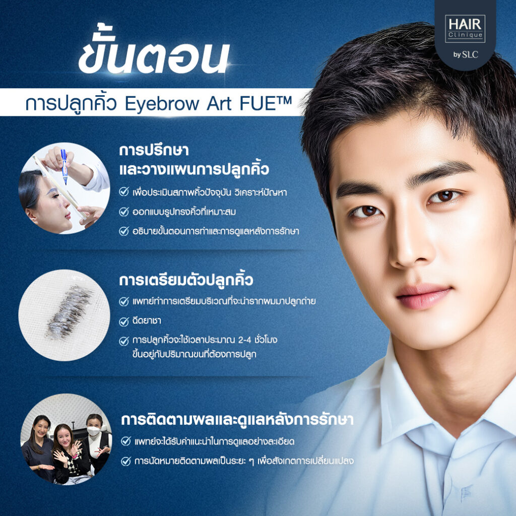 ปลูกคิ้วผู้ชาย, ปลูกคิ้วราคา, ปลูกคิ้วธรรมชาติ, ปลูกคิ้วดีไหม, ปลูกคิ้วที่ไหนดี