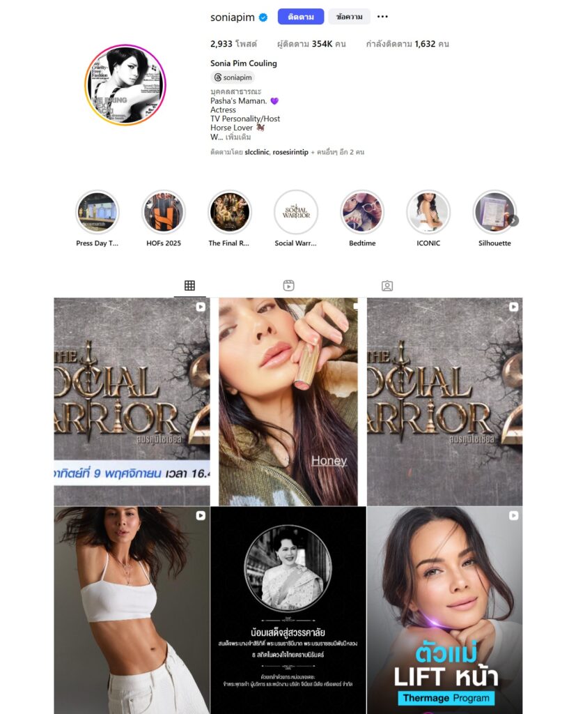 พิม ซอนย่า ปลูกผม, ปลูกผมเทคนิค Long Hair Ready™, ดาราปลูกผมที่ไหน, หัวเถิก, กรอบหน้าชัด