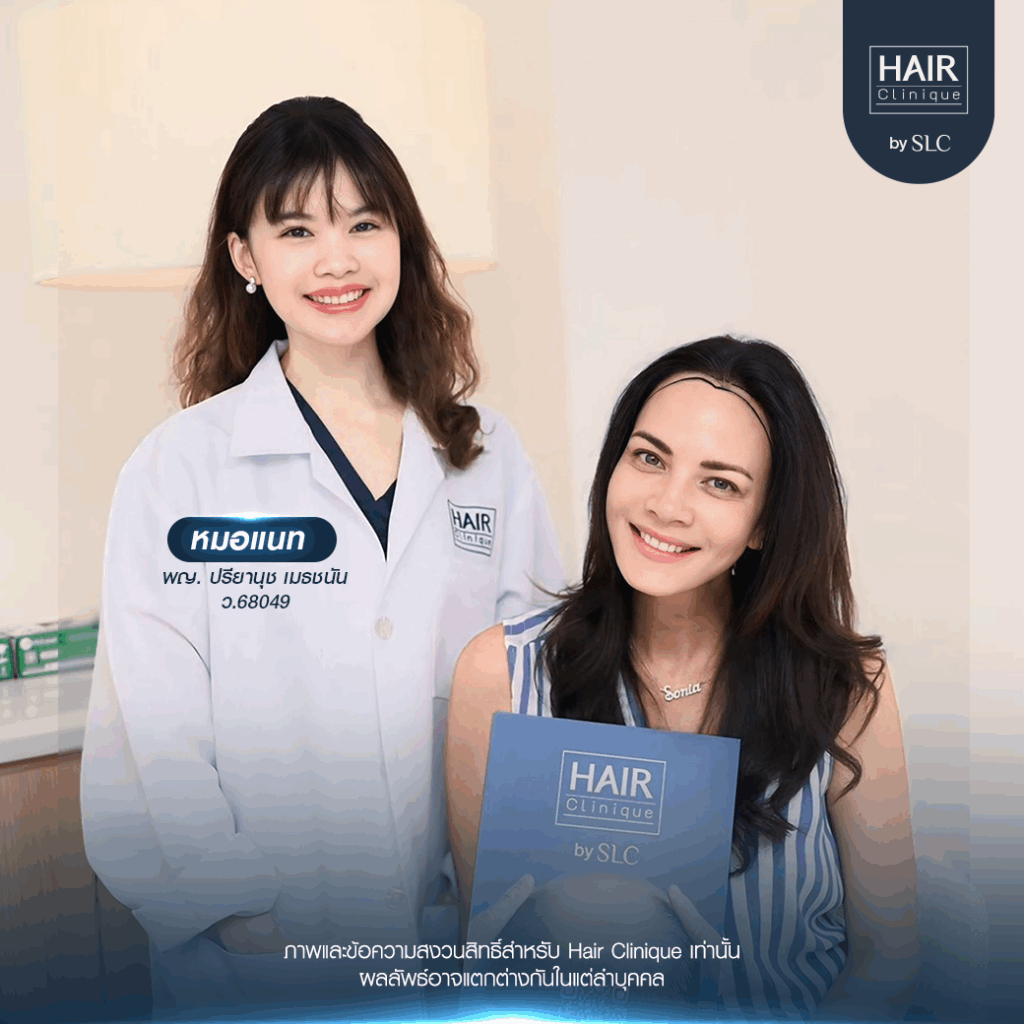 พิม ซอนย่า ปลูกผม, ปลูกผมเทคนิค Long Hair Ready™, ดาราปลูกผมที่ไหน, หัวเถิก, กรอบหน้าชัด