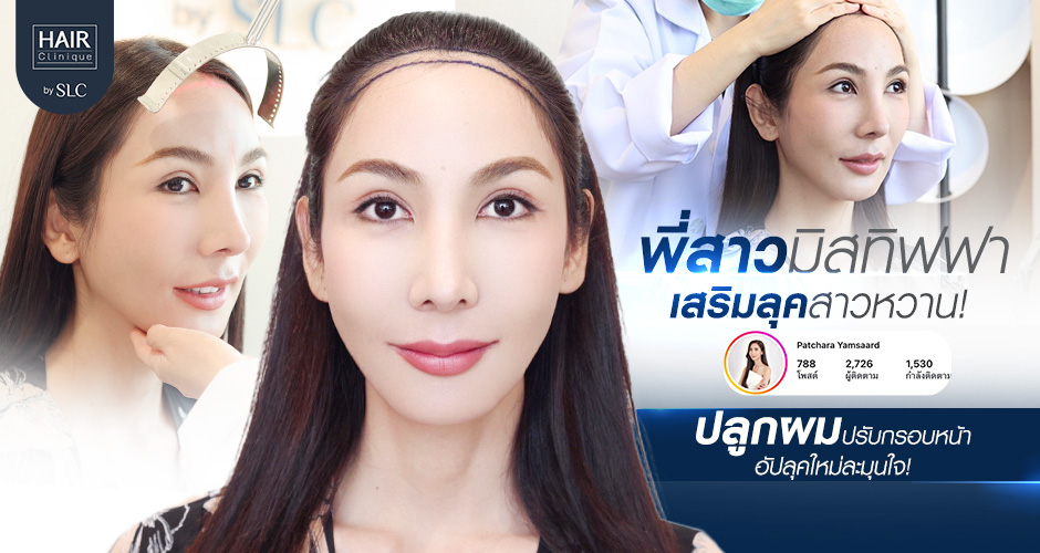 พอร์ช Miss Tiffany’s ปลูกผม, ปลูกผม Long Hair Ready™, มิสทิฟฟานี่, ปรับกรอบหน้า, ปรับกรอบหน้า, หน้าหวานละมุน