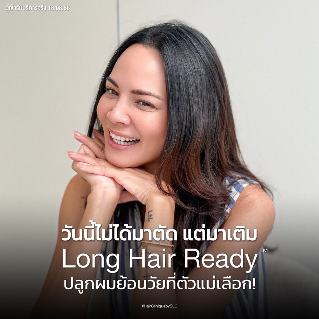 พิม ซอนย่า ปลูกผม, ปลูกผมเทคนิค Long Hair Ready™, ดาราปลูกผมที่ไหน, หัวเถิก, กรอบหน้าชัด