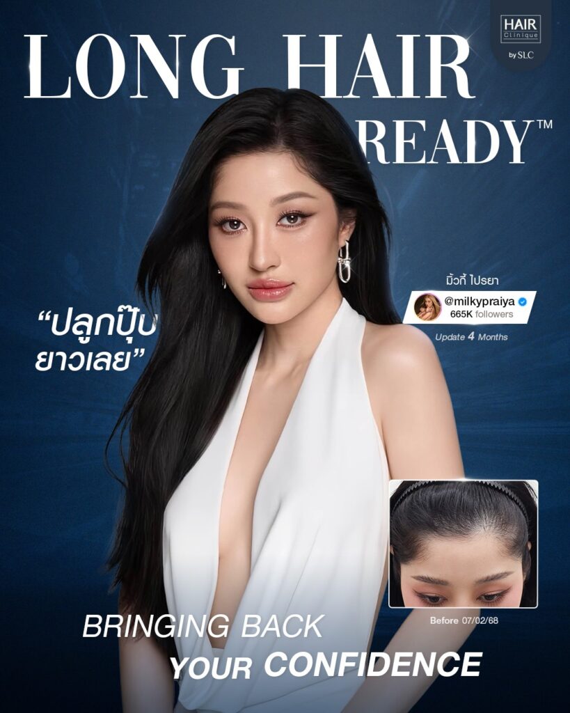 ดาราปลูกผม, ปลูกผมถาวร, ดาราผมบาง, เทคนิคปลูกผม, ปลูกผมที่ SLC, คนดังปลูกผม, มิ้วกี้ ไปรยา