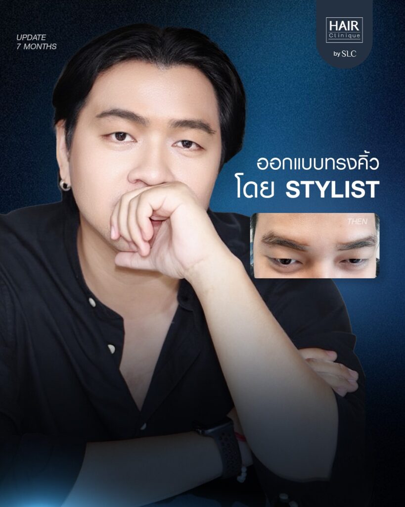 ปลูกคิ้วผู้ชาย, ปลูกคิ้วราคา, ปลูกคิ้วธรรมชาติ, ปลูกคิ้วดีไหม, ปลูกคิ้วที่ไหนดี