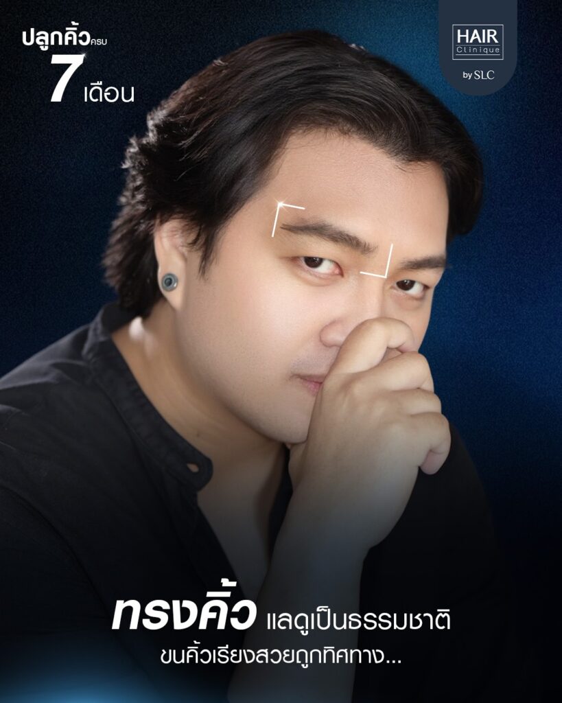 ปลูกคิ้วผู้ชาย, ปลูกคิ้วราคา, ปลูกคิ้วธรรมชาติ, ปลูกคิ้วดีไหม, ปลูกคิ้วที่ไหนดี