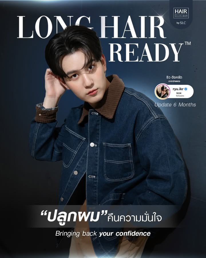 ดาราปลูกผม, ปลูกผมถาวร, ดาราผมบาง, เทคนิคปลูกผม, ปลูกผมที่ SLC, คนดังปลูกผม, ริว อิงครัต